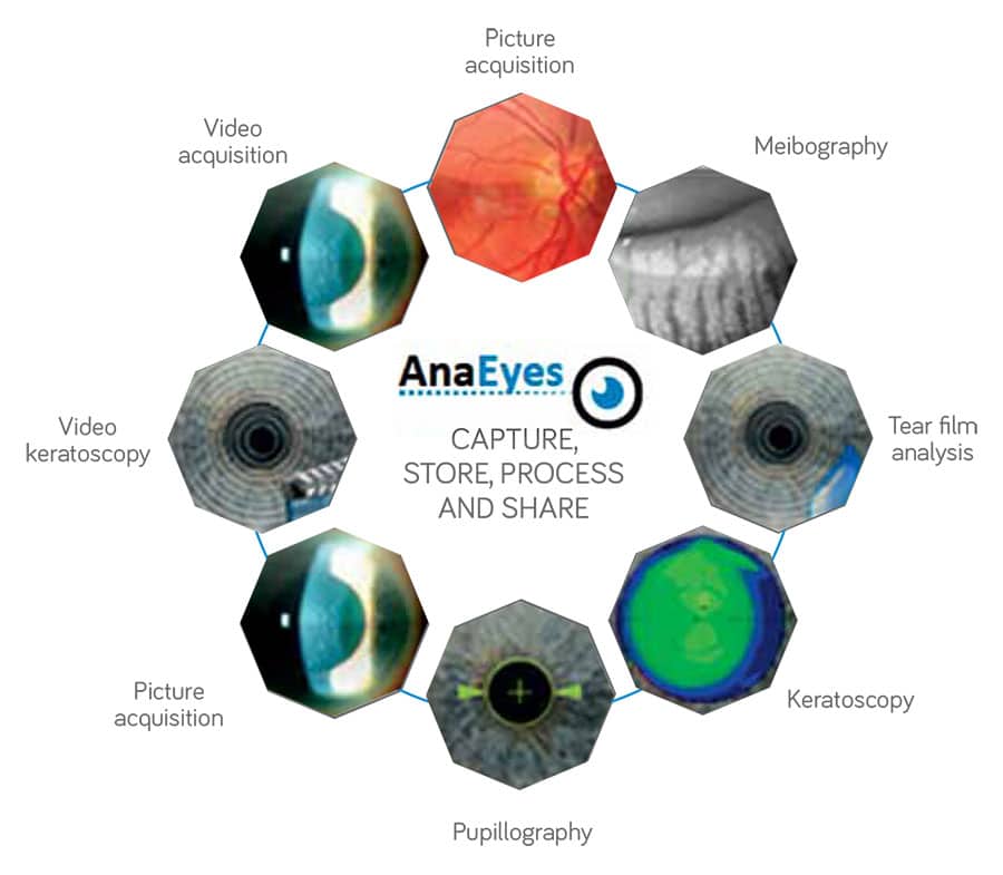 AnaEyes Software