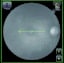 OCT500 Advanced Robotic OCT - Essilor Instruments USA