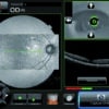 OCT500 Advanced Robotic OCT - Essilor Instruments USA