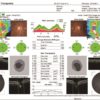 OCT500 Advanced Robotic OCT - Essilor Instruments USA